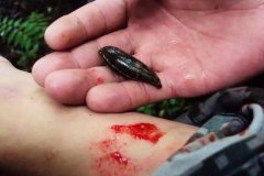 螞蟥咬人怎么辦？螞蟥怎么能殺死？